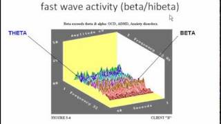 Introduction to Neurofeedback Module 1 BCIA Curriculum [upl. by Karim433]