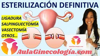 ESTERILIZACIÓN DEFINITIVA LIGADURA DE TROMPAS Y OTRAS ✂️ TÉCNICA ✂️  Ginecología y Obstetricia [upl. by Nonrev334]