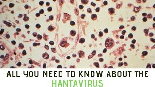 All you need to know about the Hantavirus [upl. by Oberstone]