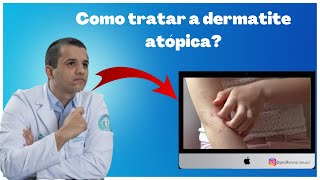 Dermatite atópica como aliviar a coceira [upl. by Kaja728]