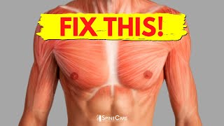 How to Fix Chest Muscle Tightness in 30 SECONDS [upl. by Lidaa44]