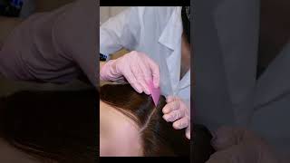 ASMR Doctor SCALP Check  Hairline Therapy Sharp or Dull Real Person shorts short asmr [upl. by Itida]