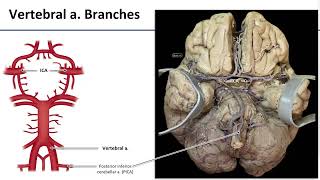 LO5 Arterial Supply to Brain [upl. by Lleksah]