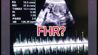 U Tell Me Baby Gender On Ultrasound 🙂  FHRV Cephalic or Breech  Placenta Posterior or Anterior [upl. by Aidnyc422]