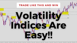 How To Trade Volatility Indices Institutional Trading Strategies [upl. by Ab]