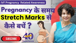 How to Prevent Stretch Marks During Pregnancy  Expert Tips by Dr Malti Bhojwani [upl. by Myrlene]