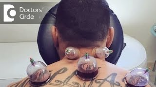 What are the benefits of Hijama or Cupping Therapy  Dr Shagufta Siraj [upl. by Damian921]