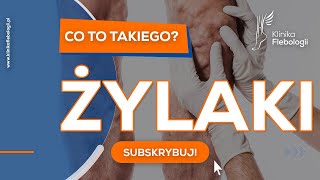 Żylaki  co to takiego [upl. by Ayr164]