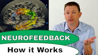 How Does Neurofeedback Therapy Work [upl. by Enihpled]