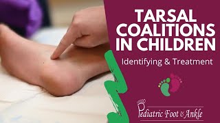 Identifying amp Treating Tarsal Coalitions in Children [upl. by Orabelle]