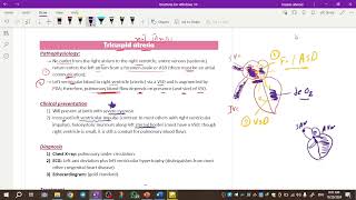 Pediatrics cardiology  tricuspid atresia amp ebstein anomaly amp truncus arteriosus [upl. by Otirecul]