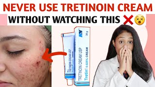 How to use TRETINOIN CREAM In Tamil TRETINOIN MISTAKES IN TAMIL [upl. by Wardle]