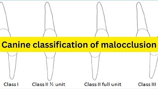 Canine classification of malocclusion SIMPLIFIED [upl. by Caswell]