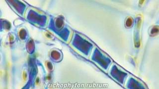 Dermatophytes Ringworm Microsporum amp Trichophyton Fungi [upl. by Padraic607]