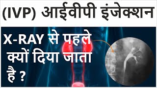 Intravenous Pyelogram in Hindi  Intravenous Pyelogram Procedure  IVP Test for Kidney [upl. by Rusticus]