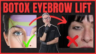 Why Botox Will Droop Your Eyes And How To Prevent This  Dr Rajani [upl. by Trill372]