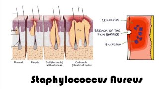 Staphylococcus aureus  complete overview  microbiology [upl. by Farr]