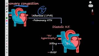 Therapeutics Heart Failure 1 [upl. by Rogers]