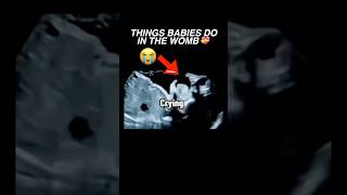 Things babies do in the womb ultrasound pregnancy baby cutebaby womenshealth [upl. by Ecirtac444]