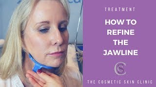 How To Refine The Jawline  The Cosmetic Skin Clinic [upl. by Camilla133]