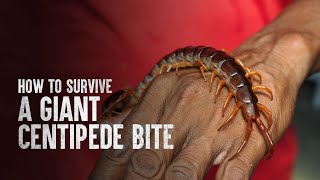 How to Survive a Giant Centipede Bite [upl. by Laenej170]