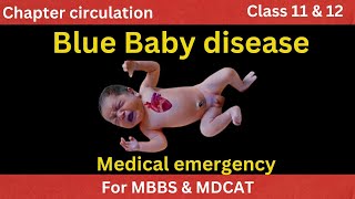 What Is Blue Baby Disease  Why Babies Turn Blue After Birth [upl. by Tamsky]