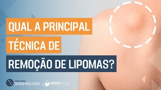 Qual a principal TÉCNICA de remoção de LIPOMAS [upl. by Roderick]