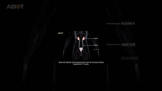 URO dot AI AI based urinary stone detection system [upl. by Grefe]