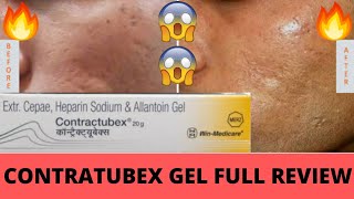 Contratubex Gel Full Review Effects and Side Effects Best for Skin Scars पुराने दाग गायब 🔥😃👍 [upl. by Deach758]