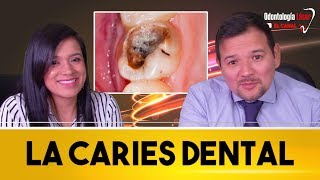 ELIMINAR LA CARIES DENTAL SIN FRESA [upl. by Leynwad]