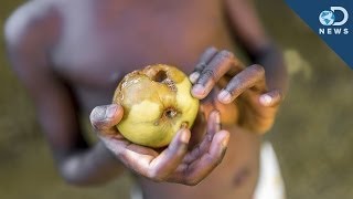 Why Malnourished Children Might Never Recover [upl. by Aracahs]