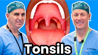 Tonsils Should You Get Yours Taken Out [upl. by Saxet]