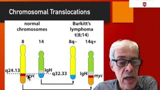 25 The case of Burkitt’s lymphoma [upl. by Oile284]