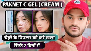 Paknet c gel uses dose benefits and Side effects full review in hindi [upl. by Emoryt]