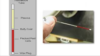 How to Measure the Hematocrit  physio lab practical [upl. by Oidacra]