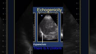 POCUS Essentials Describing Echogenicity [upl. by Nuahsed]