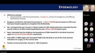 Cervical Spondylotic Myelopathy presented by Michael Pompliano MD on April 1 2024 [upl. by Auqinahc]