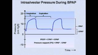 NonInvasive Positive Pressure Ventilation Mechanical Ventilation  Lecture 6 [upl. by Sorkin]