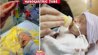 How to insert Nasogastric NG Tube in New born Neonate  NG tube Insertion full procedure NICU [upl. by Mathews]