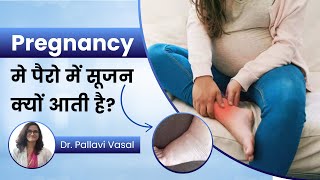 How to Reduce Swelling in Legs During Pregnancy Dr Pallavi Vasal [upl. by Namolos41]