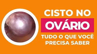 Cisto no Ovário tudo o que você precisa saber [upl. by Keare]