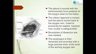 Open Ivor Lewis Esophagectomy  Surgical Steps [upl. by Yuhas]