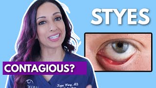 Are Styes Contagious Eye Doctor Debunks [upl. by Dulcle]