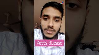 Potts disease  TB  Tuberculosis  Tubercular osteomyelitis  Dr Med [upl. by Adiahs658]