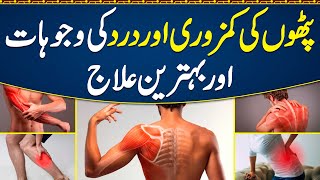 Muscles Pain ka ilaj  Myalgia Muscle Pain Treatment  How to Fix Leg Shoulder amp Back Muscles Pain [upl. by Haeckel706]