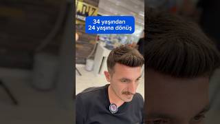 Konya saç protezi konyaprotezsaç haircut protezsac protezsaç hairstyle sacekimi barber [upl. by Eiramnna173]