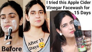 Wow Apple Cider Vinegar Foaming Facewash 15 Days Usage Unisex Facewash Honest Review tulikajagga [upl. by Aicatan]