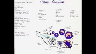 Ovarian Carcinomas  Histology Types Symptoms Diagnosis Risk Factors Treatment Prognosis [upl. by Neruat]