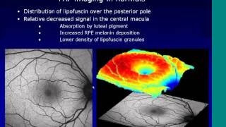 An Overview of BluePeak Autofluorescence and its Use in a Clinical Setting [upl. by Yerg]