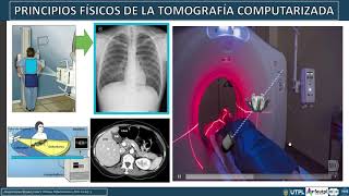 Principios Físicos de la Tomografía Computarizada [upl. by Adnola]